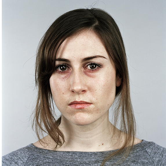 woman with dark bags under her eyes