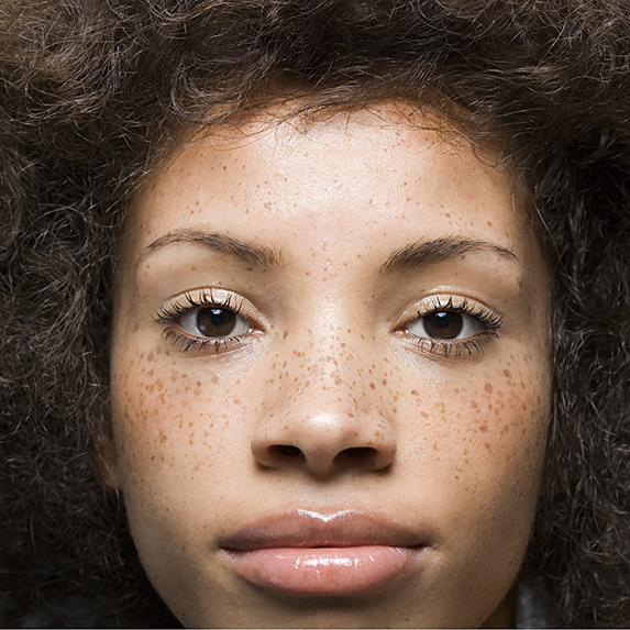 woman with beautiful freckled skin