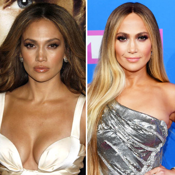 Jennifer Lopez before and after