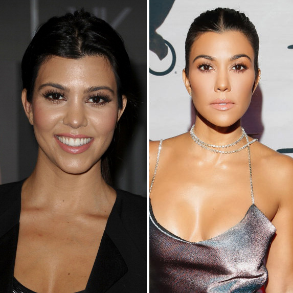 Kourtney Kardashian before and after
