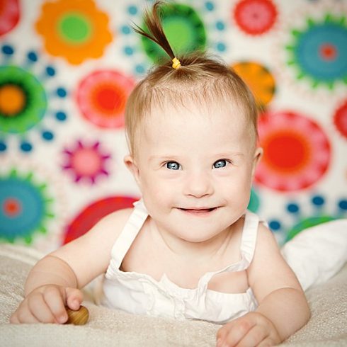 Adorable smiling blue-eyed baby girl with Down's Syndrome.
